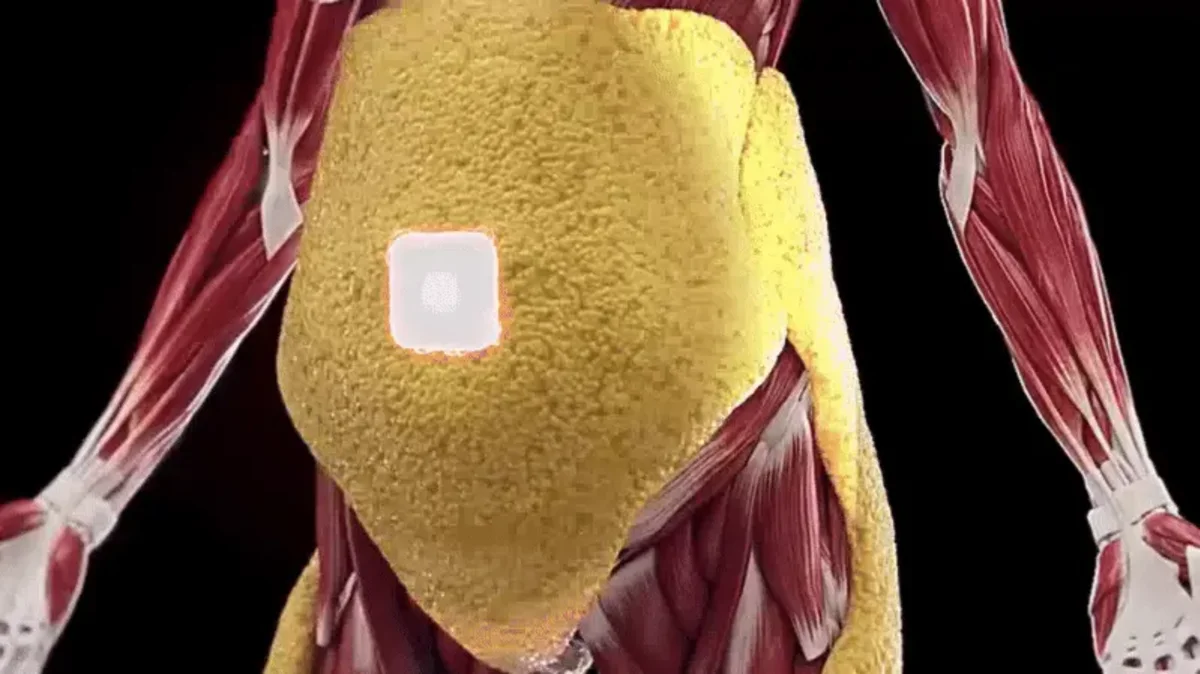 Setting My Metabolism on “Autopilot”